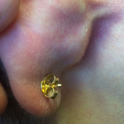 wie bekomme ich mein piercing raus siehe foto tattoo ohr