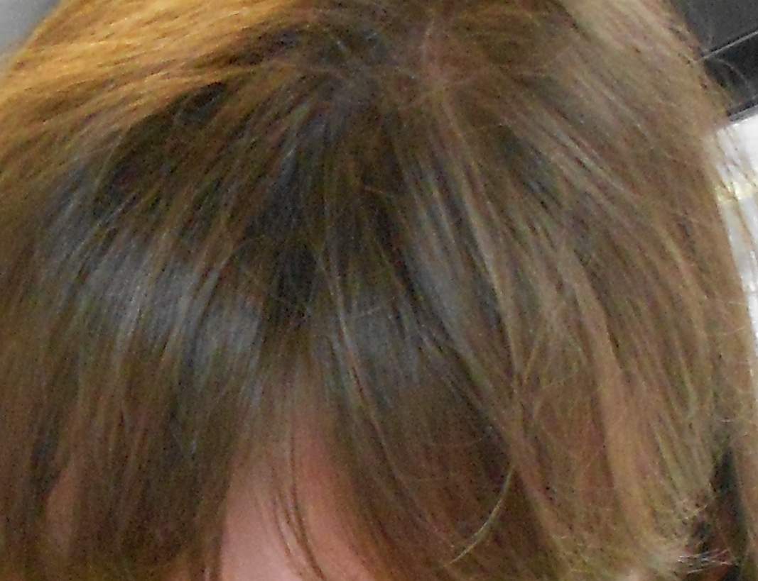 Wie Bekomme Ich Gelbstich Aus Den Haaren