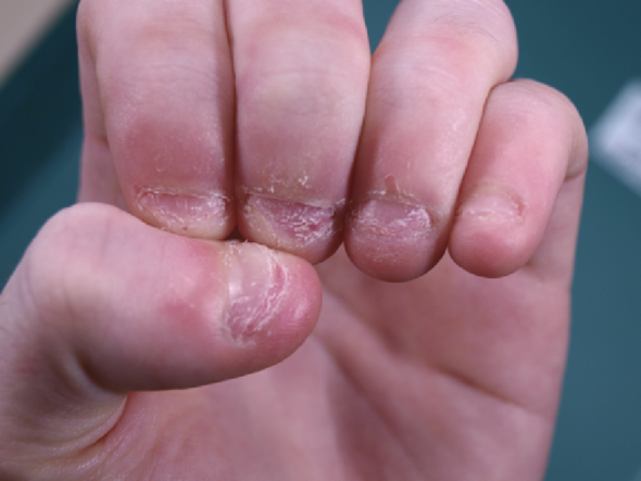 wie bekomme ich schone nagel suche tipps pflege fingernagel angewohnheit 
