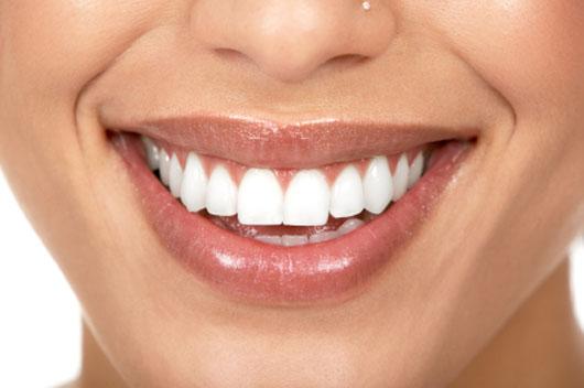 Weiße Zähne so ungefähr möchte ich die haben - (Beauty, Zähne, weiße Zähne)