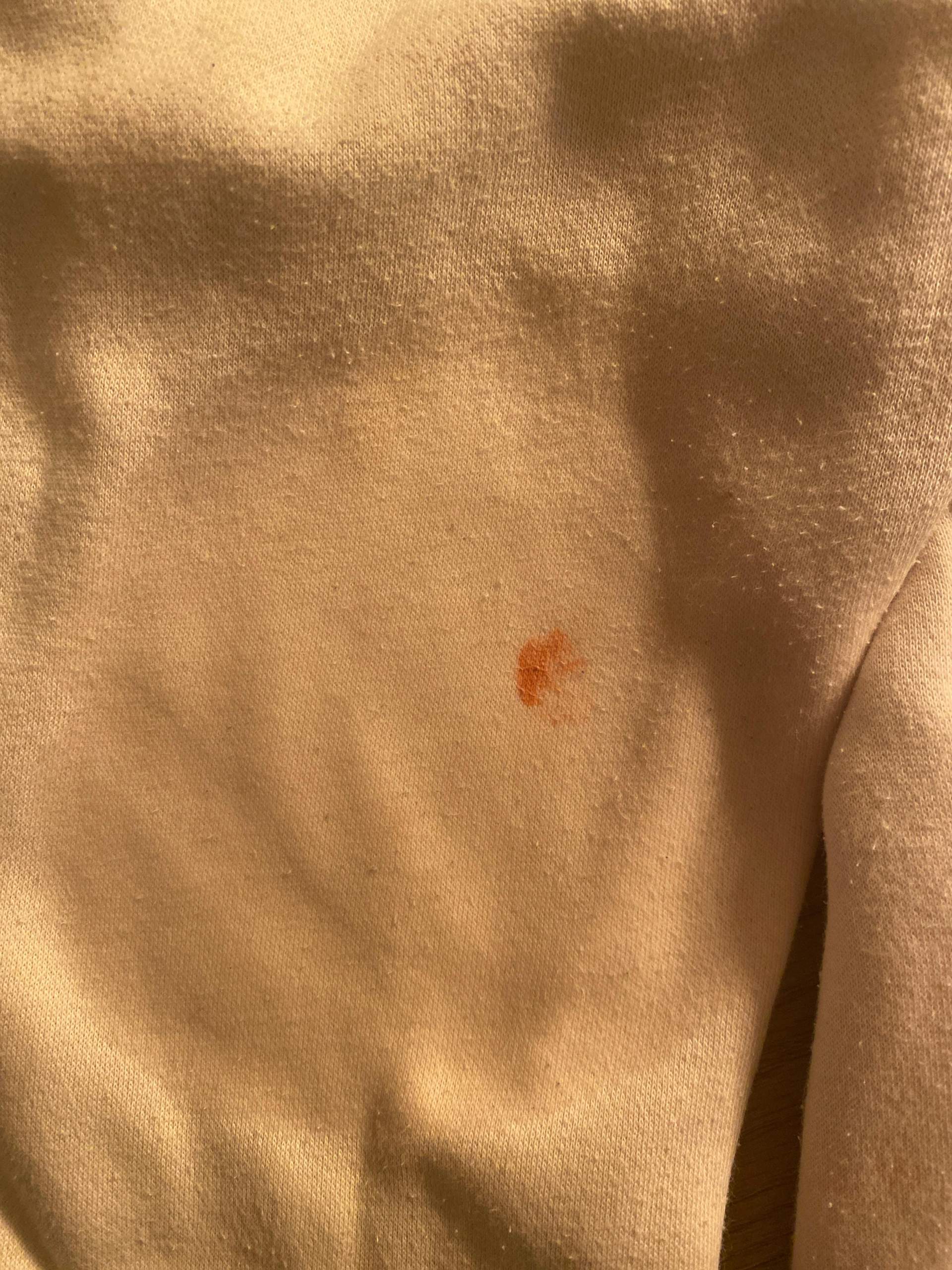 Wie bekommt man diesen Fleck schnellstmöglich weg? (Kleidung, Hose, Flecken)