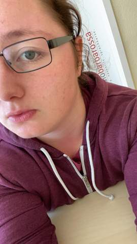 Wie Bekommt Man Eine Richtig Schone Haut Gesundheit Und Medizin Psychologie Madchen