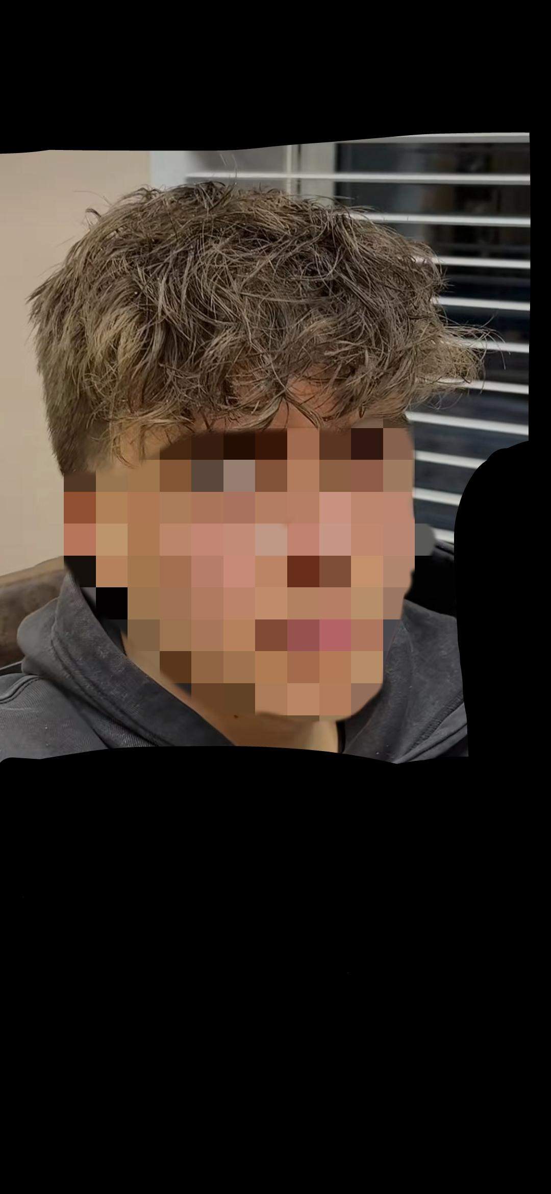 Womit Bekommt Man Harte Fußnägel Weich