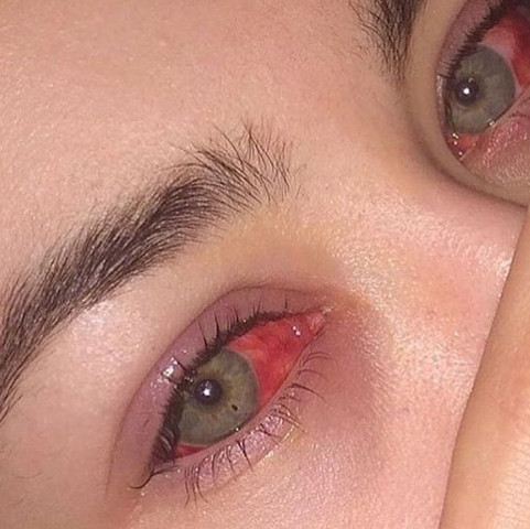 Augen warum werden die rot kiffen beim Sehr stark