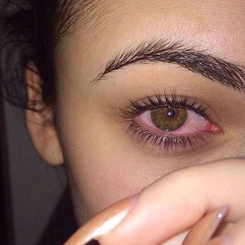 Wie Bekommt Man Komplett Rote Augen Gesundheit Korper Wie Bekommt Man Komplett Rote Augen Gesundheit Korper