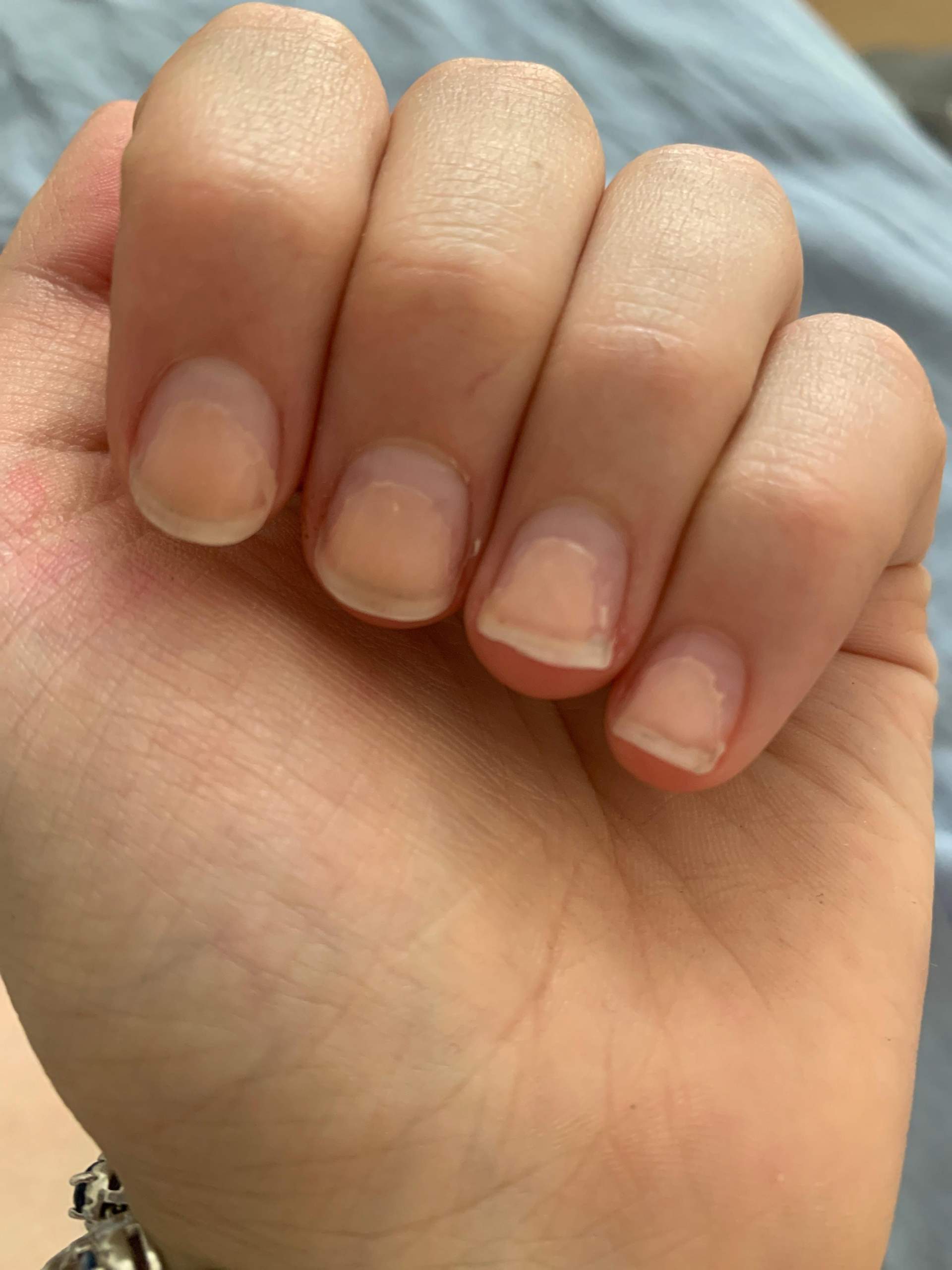 Wie Bekommt Man Nägel Mit Nagelkleber Ab