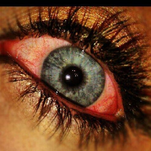 rote augen nach kiffen