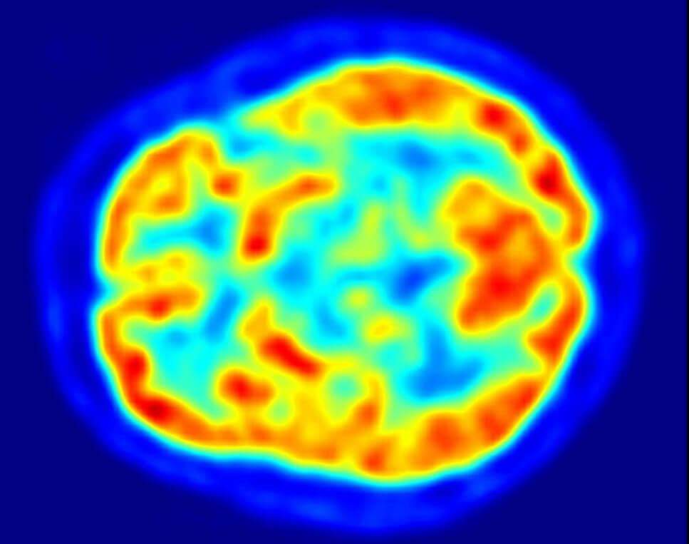 Wie entsteht die Welt im Kopf? (Bewusstsein, Nervenzellen, Neuronale Netze)