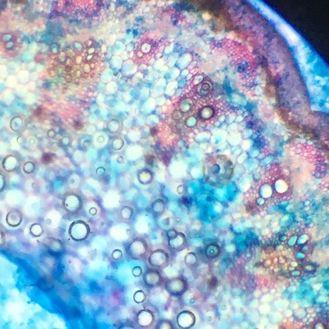 Wie erkennt man unter einem Mikroskop Xylem Phloem und Kambium?