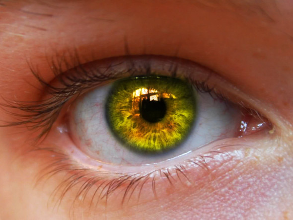 Wie Findet Ihr Augen Mit Gelbstich Gelb