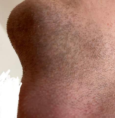 Wie findet ihr diesen (kurz) Bartwuchs?