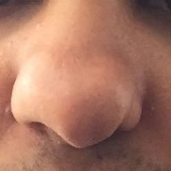 Nase Nase Nase Nase was ?? - (Frauen, Aussehen, Nase)