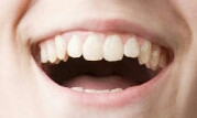 Zähne - (Gesundheit, Aussehen, Zähne)