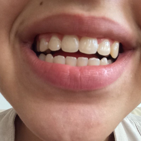 Hier meine Zähne  - (Schule, Medizin, Beauty)