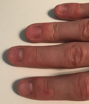 Was Kann Ich Tun Damit Wunden An Den Fingern Schnell Heilen Gesundheit Und Medizin Gesundheit Hausmittel Was Kann Ich Tun Damit Wunden An Den Fingern Schnell Heilen Gesundheit Und Medizin Gesundheit Hausmittel