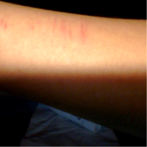 Wie Heilen Meine Wunden Besser Und Schneller Pflege Rot Wunde Wie Heilen Meine Wunden Besser Und Schneller Pflege Rot Wunde