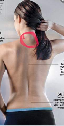 Wie heißt der Punkt am Nacken?