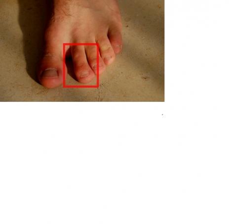 Wie heißt der Zeh neben dem großen Zeh?Wie wird er genannt? (Name)