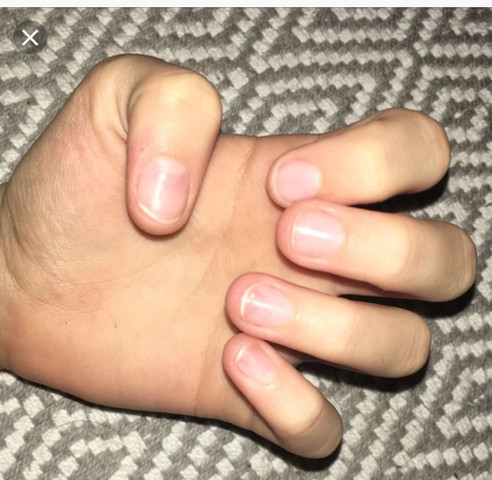 Wie Kann Ich Das Andern Fingernagel Gesundheit Beauty Hasslich