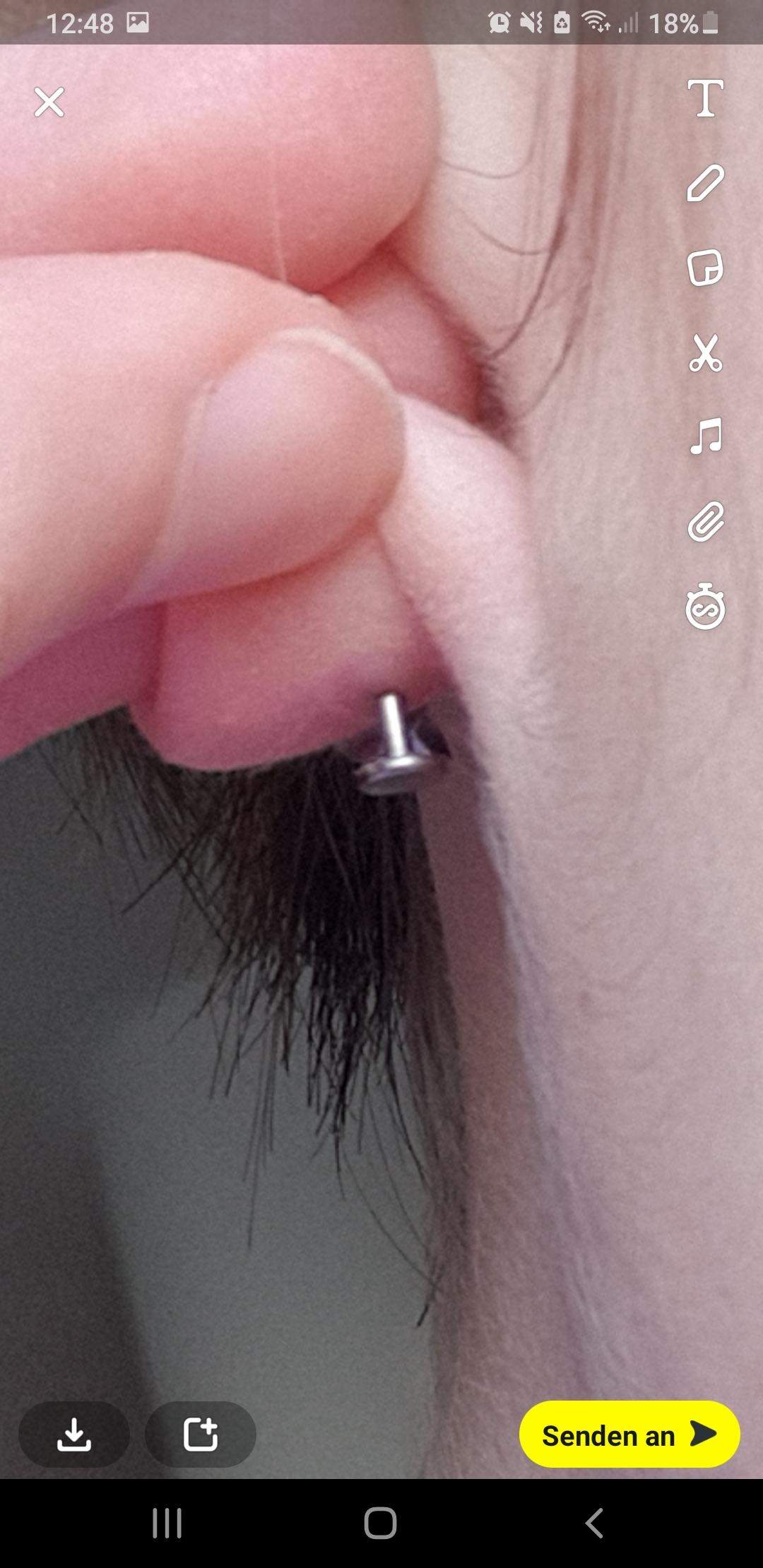 Ohrloch Entzündet Stecker Rein Oder Raus Wie kann ich diesen Stecker rausnehmen? (Piercing, Ohrloch