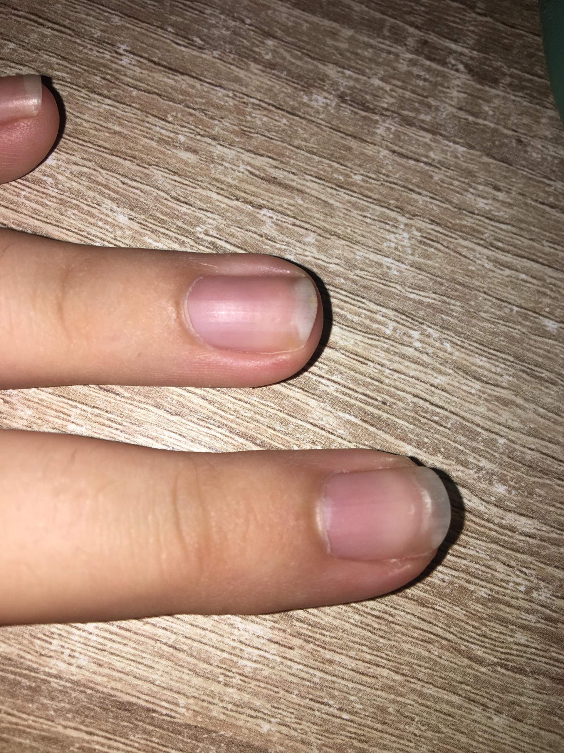 Wie kann ich gesunde Nägel bekommen? (Gesundheit, Fingernägel)