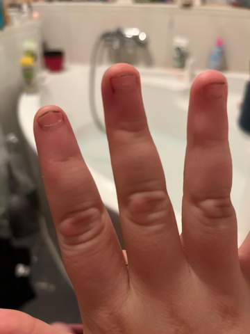 Wie kann ich meine Fingernägel sauberer und gepflegter machen?