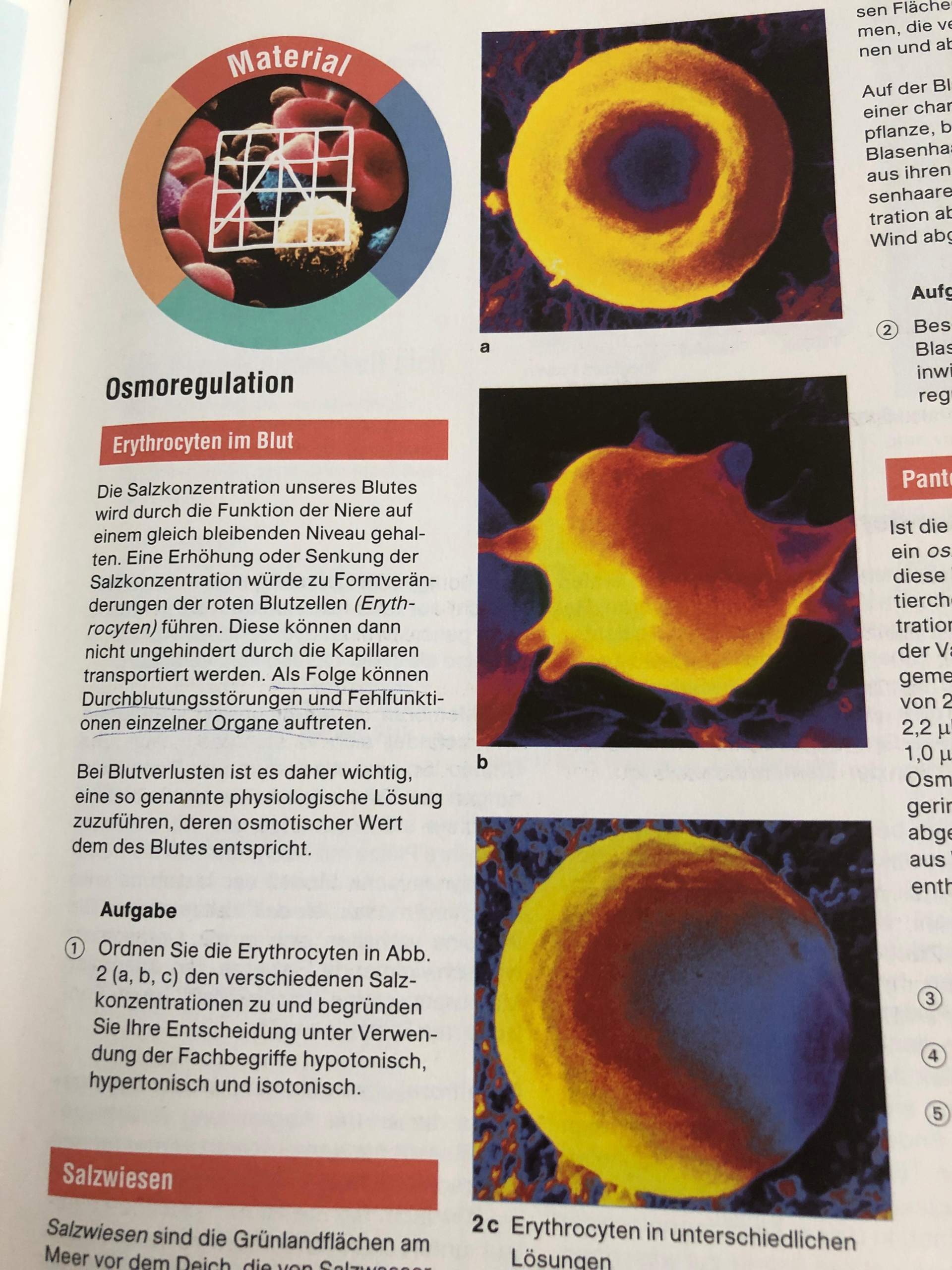 Wie kann man hypotonisch,hypertonisch und isotonisch einfach erklären ...