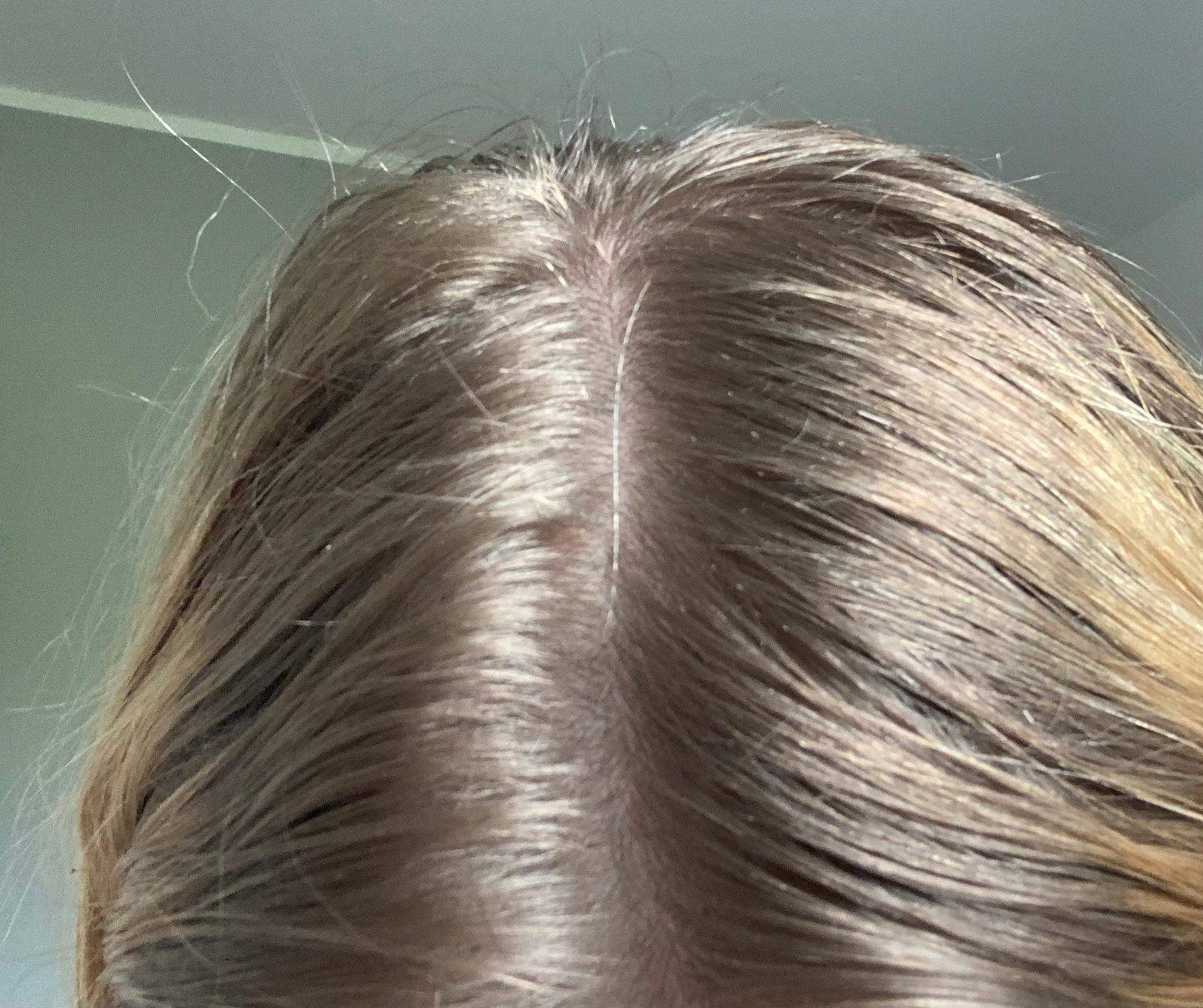 Haarfarbe Zu Lange Einwirken Lassen Haarausfall