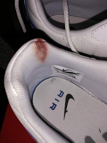 Wie Kriege Ich Blutflecken Aus Meinen Schuhen Mode Schuhe Blut