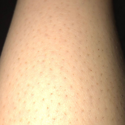 Wie Kriege Ich Einfach Schone Normale Haut Ohne Stoppel Und Diesen Punkten Das Sind Haare Unter Der Haut Beine Rasieren Schon