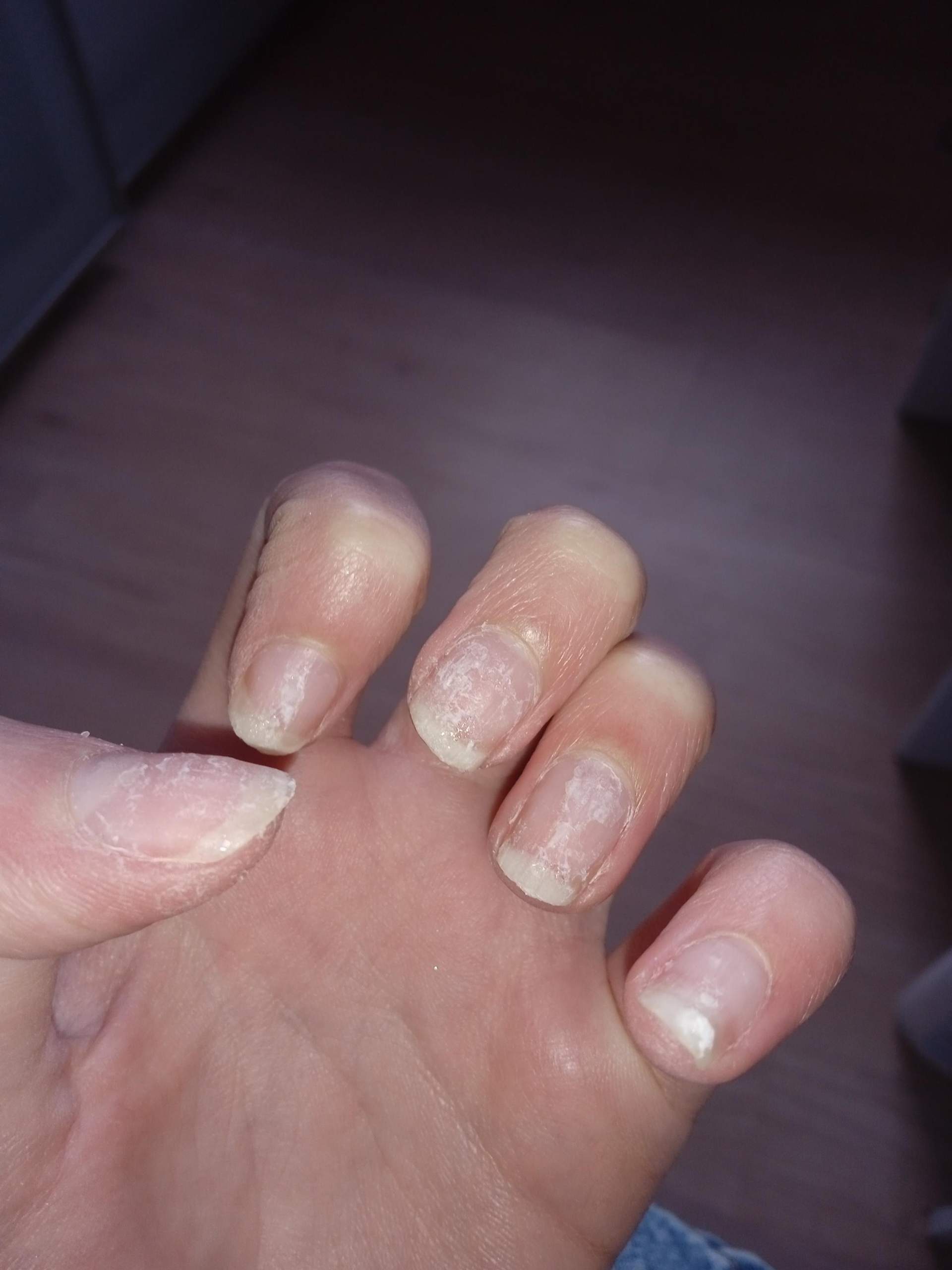Wie kriege ich Nagelkleber Reste ab? (Nägel, Fingernägel, Kunstnägel)