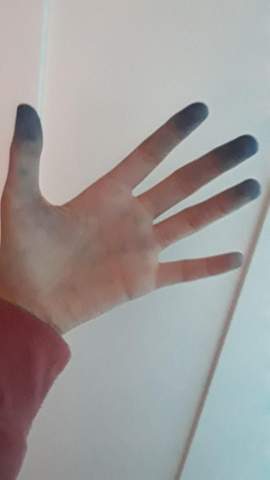 Wie Kriegt Man Fuller Tinte Von Denn Hande Ab Hand Waschen