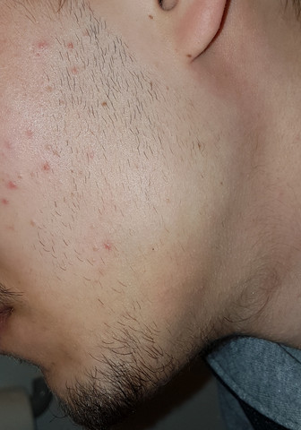 Wie Lange Brauch Ich Fur Ein Voll Bart Bartwuchs Vollbart