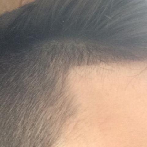 wie lange braucht das zum nachwachsen haare aussehen jugendliche
