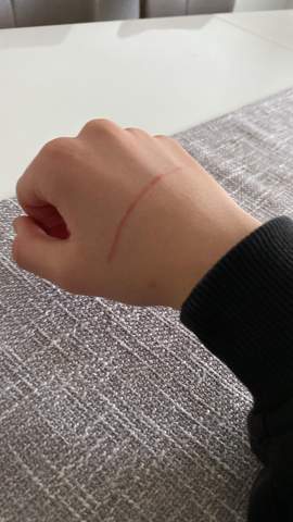 Wie lange braucht es bis diese Verletzung an meiner Hand weg geht?
