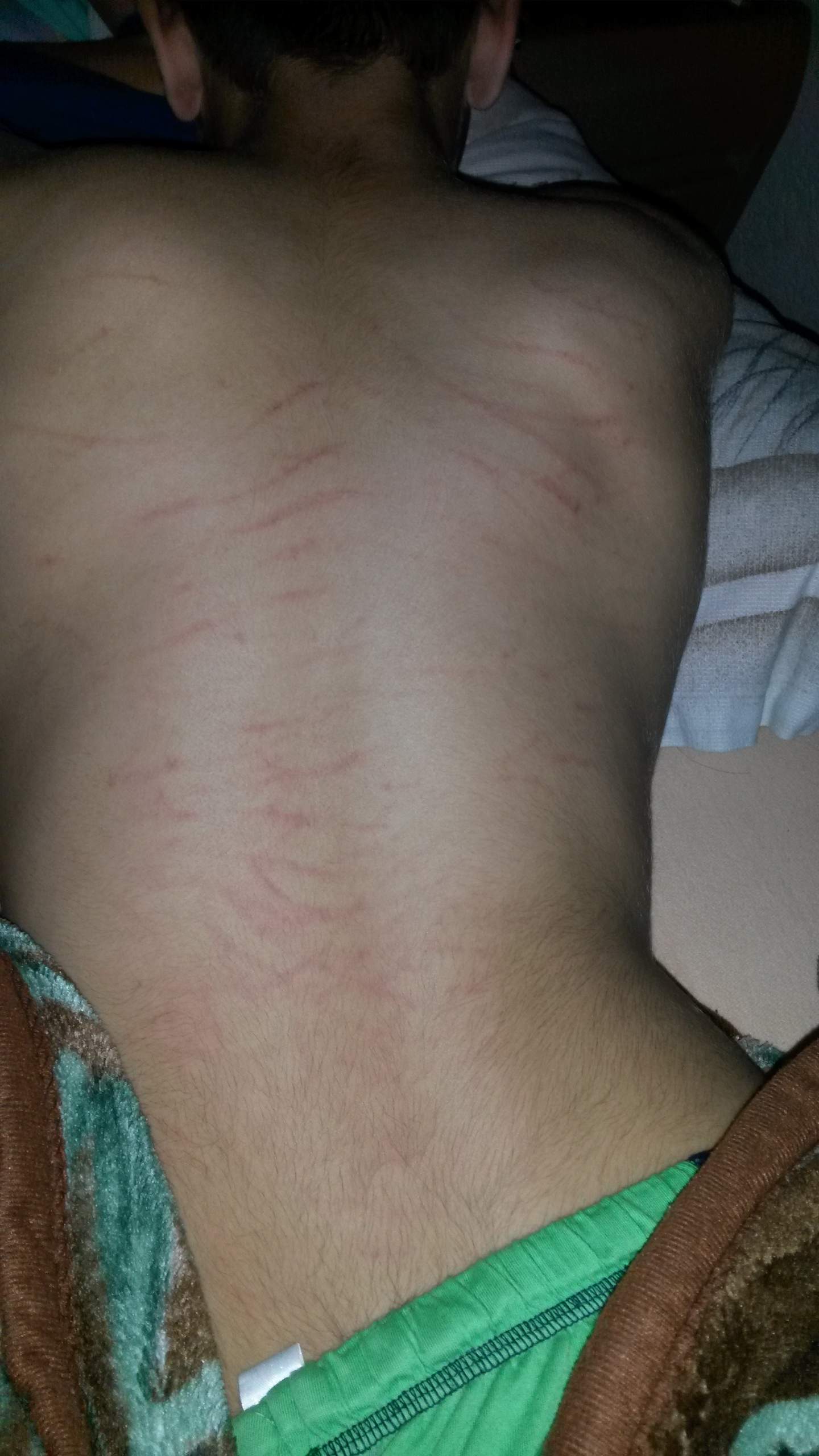 Wie lange dauert es bis die kratzer weg gehen ? (Weggehen)