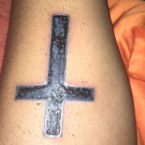 10 Tage danach  - (Haut, Tattoo, Infektion)