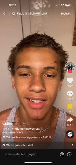 Wie lange dauert es von buzz cut bis zu diesen Haaren? (Männer ...