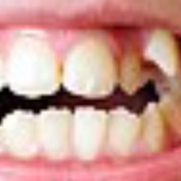 So sehen ihre Zähne jetzt aus!  - (Zähne, Zahnspange)