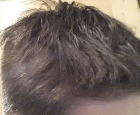 Diese Haare - (Haare, Frisur)