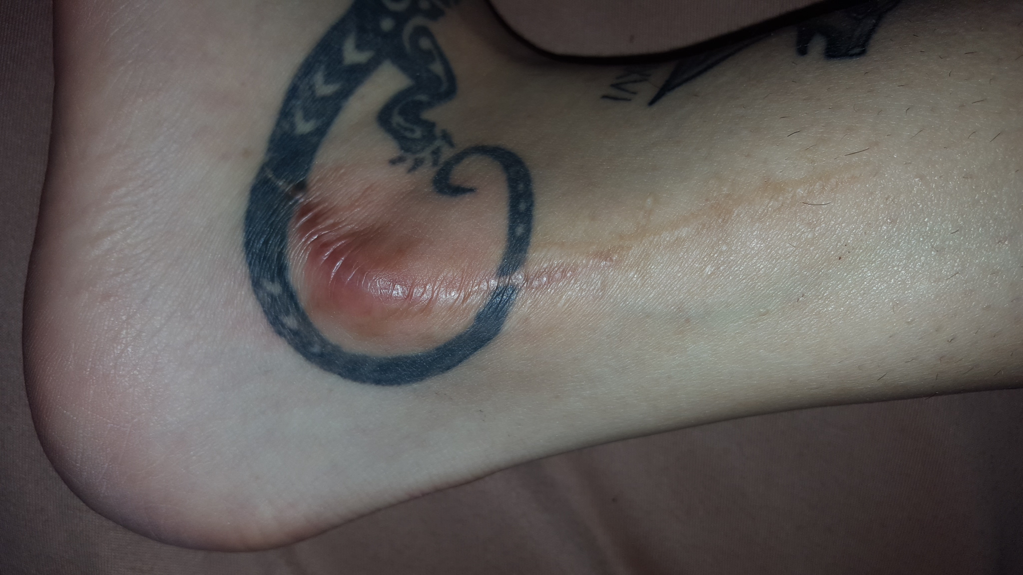 Wie Lange Warten Bis Man Narbe Ubertattoowieren Kann Tattoo Narben Cover Up