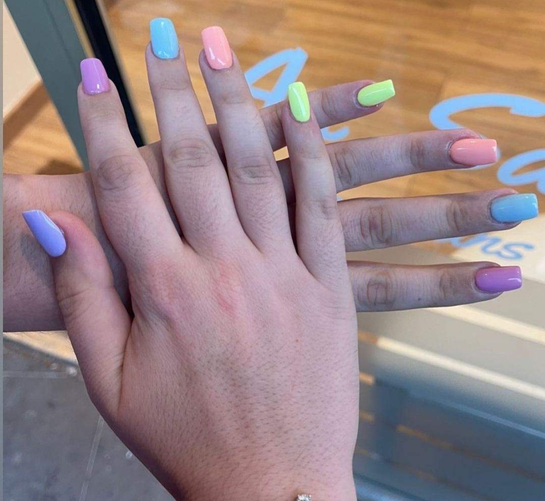 Wie nennt man diese Punkte bzw. Löcher auf dem Handrücken dieser Frau? (Psychologie, Frauen