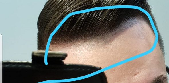 Wie Schnell Wachsen Haare Am Kopf Nach Misslungener Rasur Wieder Friseur Haarwachstum Mannerhaare