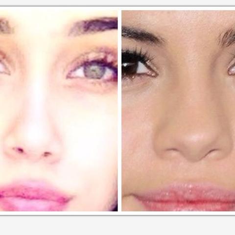 Wie Sehr Kann Man Seine Nase Andern Lassen Selena Gomez Schonheitsoperation