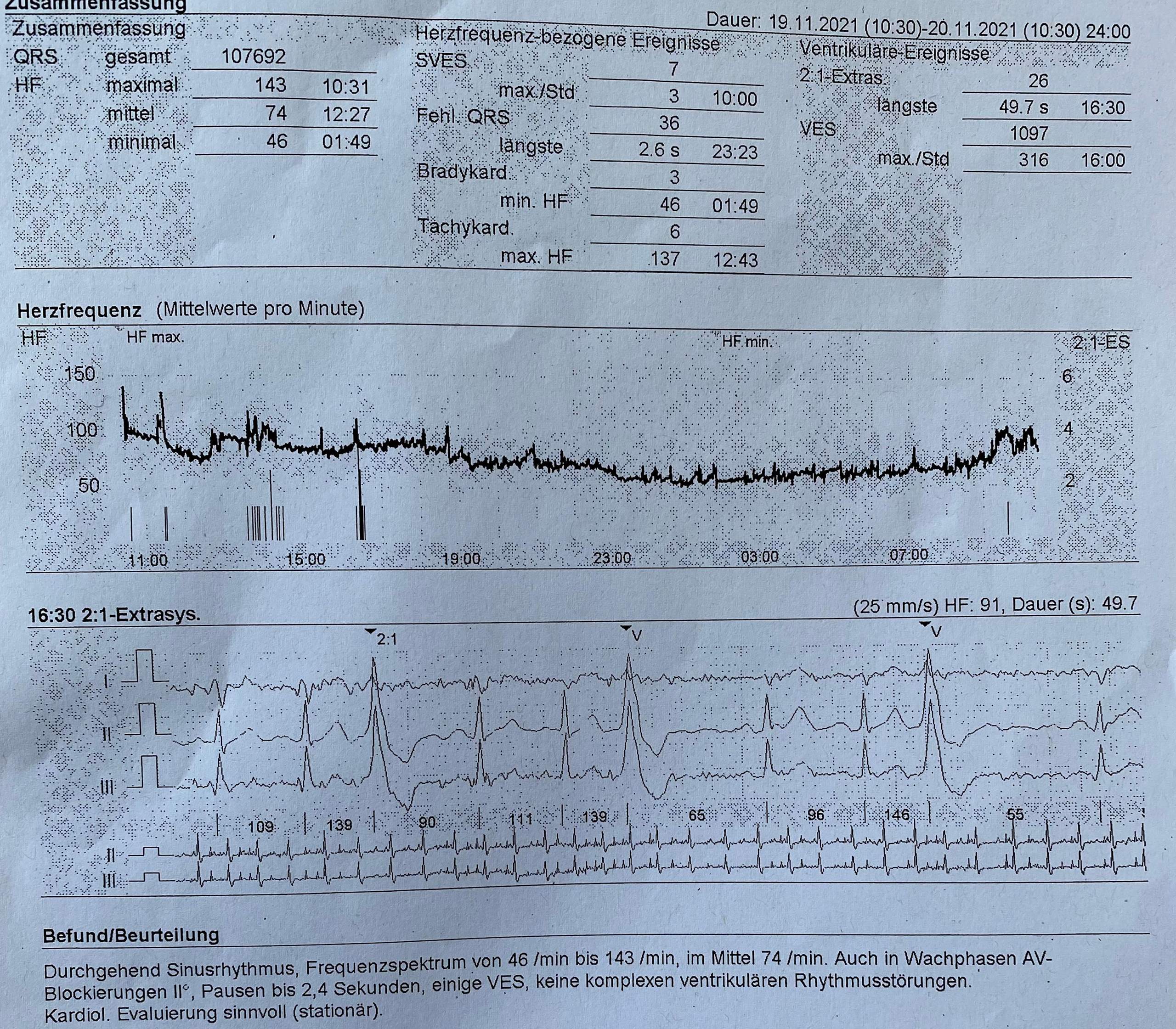Wie sieht das Ekg aus? (Medizin, Arzt, Herz)