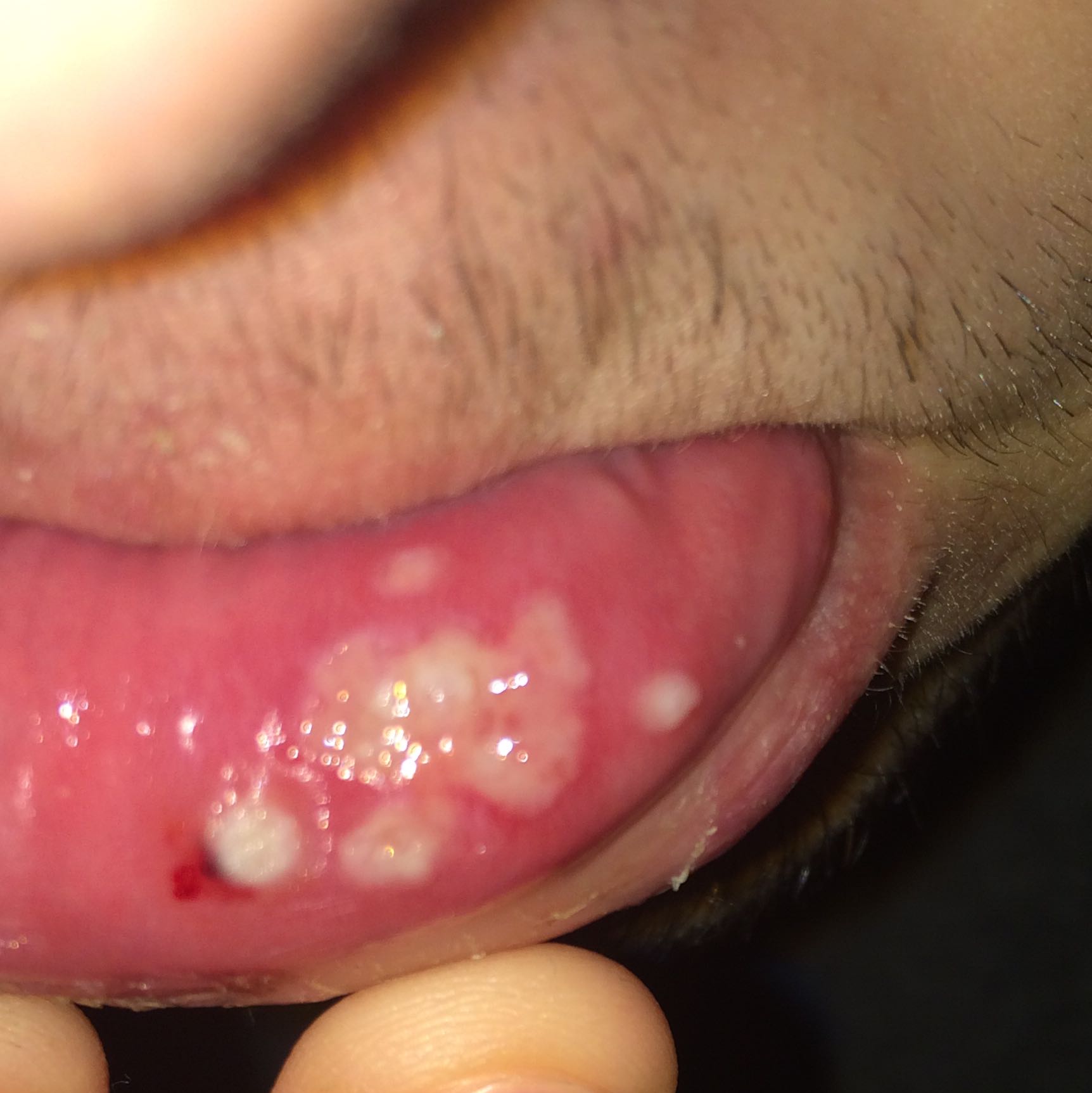 36+ Pickel Auf Der Zunge Vorne Gif