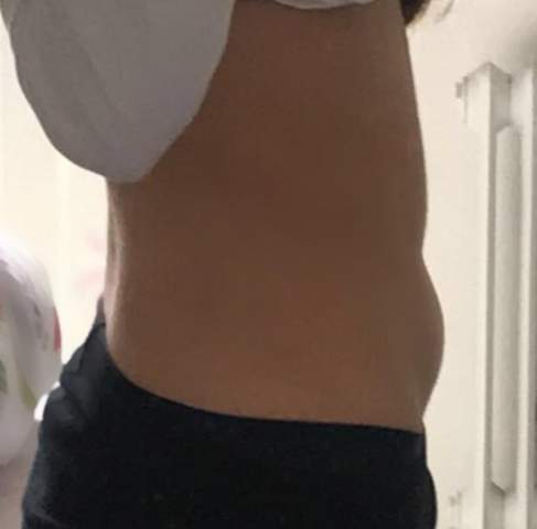 Wie Werde Ich Meinen Bauchspeck Los Oder Ist Es Hormonell Gesundheit Und Medizin Wie Werde Ich Meinen Bauchspeck Los Oder Ist Es Hormonell Gesundheit Und Medizin