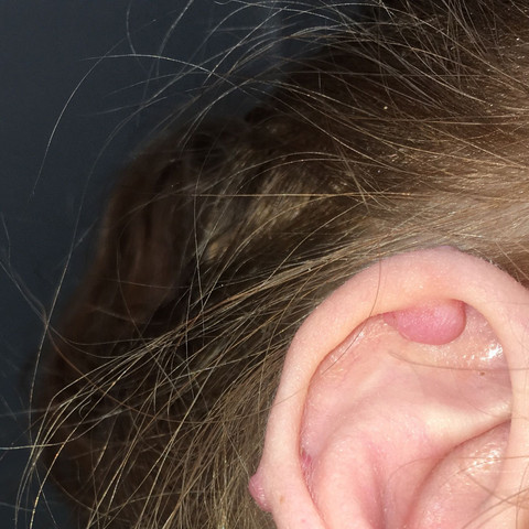 wie werde ich wildfleisch an meinem industrial los piercing