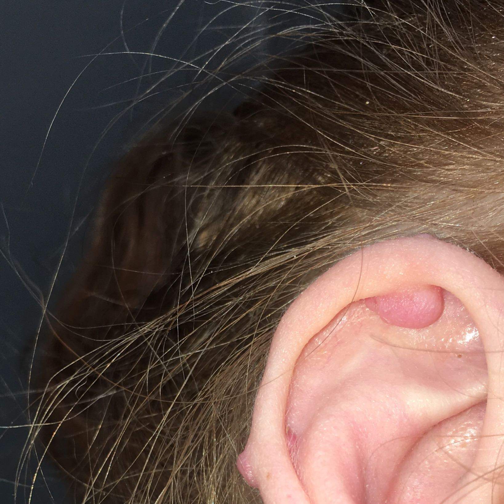 wie werde ich wildfleisch an meinem industrial los piercing