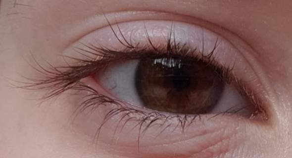 Wie würdet ihr dieses Auge beschreiben?